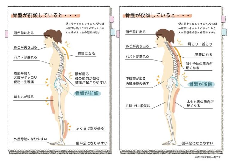 骨盤矯正・産後の骨盤矯正